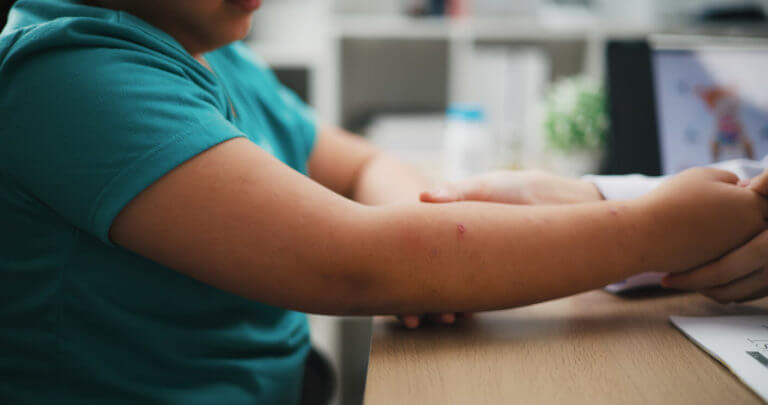 Image of a pediatric eczema specialist conducting a check-up on a child with eczema in a clinic.